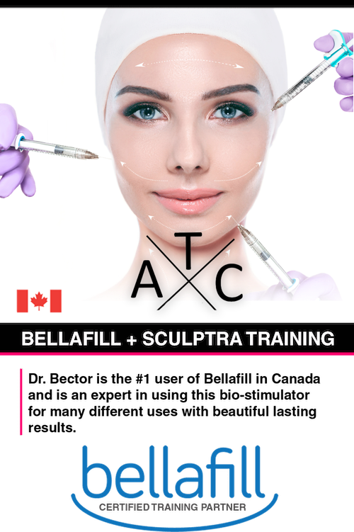 Bellafill Sculptra Training Hero